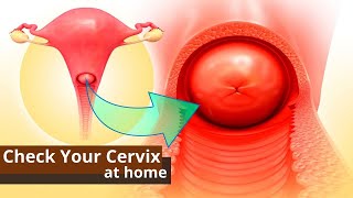 How You Can Check Your Cervix At Home  Best Ways to Know the Dilation of Cervix [upl. by Aihsram704]