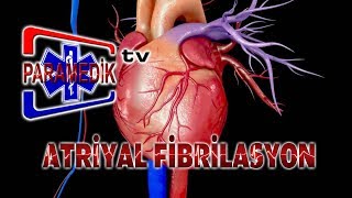 EKG  ATRİYAL ARİTMİLER  Atriyal Fibrilasyon [upl. by Nnil]