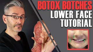 ADVANCED BOTOX ANATOMY How to avoid nasty lowerface side effects Aesthetics Mastery Show [upl. by Beaudoin]