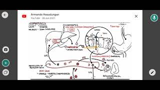 hemochromatosis [upl. by Maro]