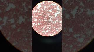 Heartworm microfilaria blood smear [upl. by Eirod]