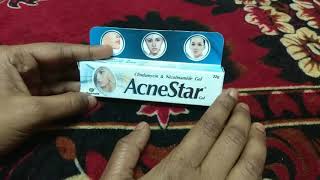 AcneStar Gel Review Effective Or Not Honest Review [upl. by Nolan]