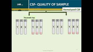 Cerebrospinal fluid Routine Analysis Microbiology Tube 2 [upl. by Madelyn]