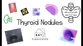 Thyroid Nodules  FRCS ENT Exam Essentials [upl. by Vyse]