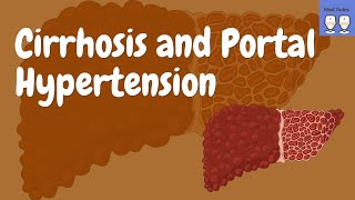 Cirrhosis and Portal Hypertension Pathophysiology Signs and Symptoms Complication Ascites [upl. by Selfridge]