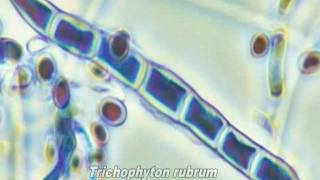 Dermatophytes Ringworm Microsporum amp Trichophyton Fungi [upl. by Eitsyrhc]