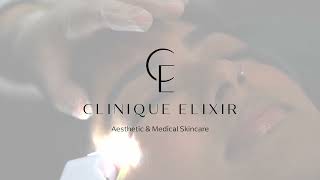 Carboxytherapie bij Clinique Elixir [upl. by Haneekas380]