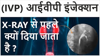 Intravenous Pyelogram in Hindi  Intravenous Pyelogram Procedure  IVP Test for Kidney [upl. by Nawtna]