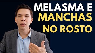 👑 O Essencial sobre Manchas do Rosto e Melasma ASSISTA [upl. by Vachill476]