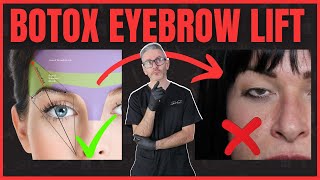 Best Botox Eyebrow Lift Injection Patterns Avoiding Spock Brow amp Ptosis [upl. by Radcliffe]