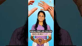 Diwali First Aid Tips For Skin Burn  Must Watch [upl. by Emrich89]