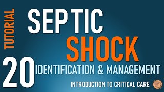 Diagnosis and Management of Septic Shock [upl. by Jobye]