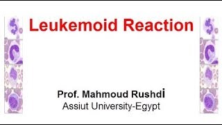 Leukemoid Reaction Arabic 2017 [upl. by Ydnik774]