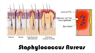 Staphylococcus aureus  complete overview  microbiology [upl. by Nadabus]