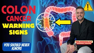 Does red meat cause colon cancer Colon Cancer Symptoms You Should Ignore [upl. by Fang]