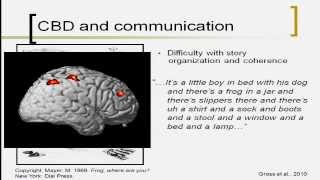 Overview of Corticobasal Degeneration and Progressive Supranuclear Palsy [upl. by Zile]