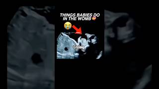 Things babies do in the womb ultrasound pregnancy baby cutebaby womenshealth [upl. by Innis]