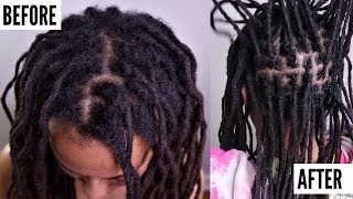 ALL About INTERLOCKING Locs  Does It Cause THINNING  Dreadlock QampA [upl. by Nilesoj]