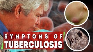 What is tuberculosis  symptoms of TB in all types and stages [upl. by Adnamar]