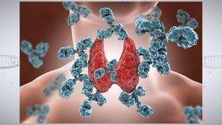 Understanding Autoimmune Thyroid Disease [upl. by Refinne1]