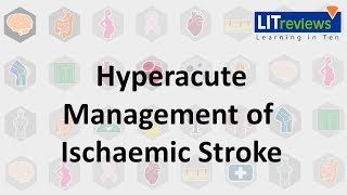 Hyperacute Management of Ischaemic Stroke [upl. by Onaicilef489]