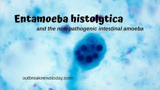 Entamoeba histolytica and the nonpathogenic intestinal amoeba [upl. by Files559]