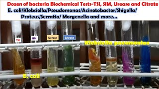 Various Bacteria Biochemical Tests E coli KlebsiellaPseudomonasAcinetobacterProteusMongenella [upl. by Onaivlis]