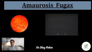 Amaurosis Fugax What is it What Causes it Will I go Blind How is it Treated I Dr Rehan 2021 [upl. by Marmaduke993]