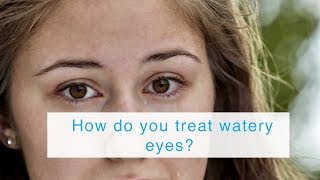 How do you treat watery eyes [upl. by Antonietta]