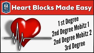 AV Heart Blocks Made Easy  1st 2nd 3rd Degree ECG Interpretation Explained [upl. by Genaro]