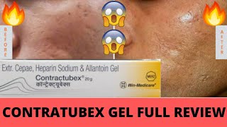 Contratubex Gel Full Review Effects and Side Effects Best for Skin Scars पुराने दाग गायब 🔥😃👍 [upl. by Parent]