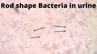 Rod shape Bacteria in urine  Motile and non motile  medicallabtechnologysajal6903 [upl. by Strohl]