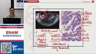 OBSTETRICIA ENAM  MAPA MENTAL HEMORRAGIA I MITAD DEL EMBARAZO QX MEDIC 2021 ENAM [upl. by Ozan]