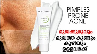 മുഖത്ത് കുണ്ടും കുഴിയും ഉള്ളവർക്ക്  Bioderma Sebium Hydra For Acne Prone Skin [upl. by Beckman]