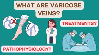 Varicose Veins EXPLAINED Pathophysiology clinical signs confirmation treatments [upl. by Alin]