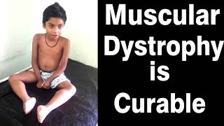 muscular dystrophy treatment in ayurveda  duchenne muscular dystrophy ayurvedic treatment [upl. by Yttik594]