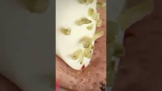 Skincare  Blackheads Removal 160 skincare skincare blackheads blackheads [upl. by Acissaj]