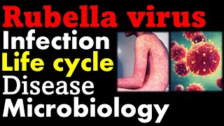 Rubella virus microbiology  infection pathology symptoms and replication cycle [upl. by Idnar356]