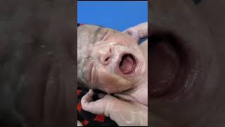 Look at the Full Vernix on Face and Body Of The New Baby BornCleaning Process With Oil youtuber [upl. by Kcirredal]