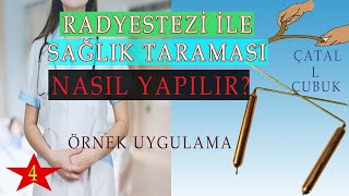 ÜCRETSİZ CHECKUP KENDİN YAP  RADYESTEZİ ÇUBUĞU İLE HASTALIK TESPİTİ NASIL YAPILIR ÇATAL VE L ÇUBUK [upl. by Oran]