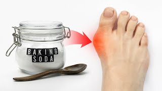 The 1 Remedy for Gout Attacks WORKS FAST  Dr Berg [upl. by Eycal9]