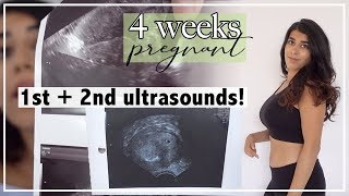 4 Weeks Pregnant  Early Ultrasound and Ectopic Pregnancy Scare [upl. by Redman983]