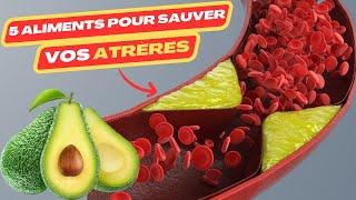 5 aliments pour sauver vos artères  maladie cardiaque  crise cardiaque  cardiac catheterization [upl. by Augie]