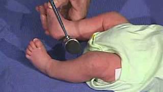 physical exam Newborn NormalReflexesDeep Tendon Reflexes [upl. by Anilorac]