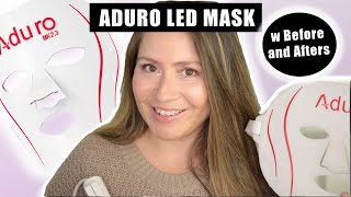 ADURO LED MASK REVIEW W BEFORE AND AFTERS [upl. by Ahsemak]