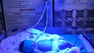 Treatment of jaundice at phototherapy newborn baby treatmentyoutubevideo viralvideo newbornbaby [upl. by Diandra31]