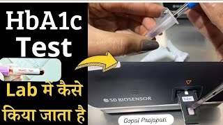 HbA1c test full procedureHbA1c test कैसे किया जाता हैं HbA1c test by SD BIOSENSER f200 Dr Gopal [upl. by Craggie]