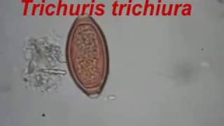 Trichuris trichiura and Ascaris lumbricoides [upl. by Qooraf]