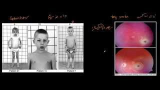 الدهون الاسفنجية  Sphingolipids [upl. by Rudd]