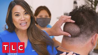 Rubens Bump Has Been Growing For 16 Years  Dr Pimple Popper [upl. by Suiramaj266]